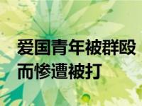 爱国青年被群殴  爱国青年因言论与网友相斥而惨遭被打