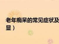 老年痴呆的常见症状及治疗方法 老年痴呆4大早期症状很明显）