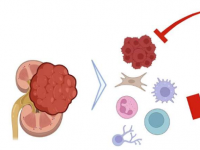 研究揭示了肾癌耐药性的意外机制