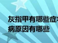 灰指甲有哪些症状表现怎么治疗 灰指甲的发病原因有哪些